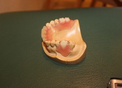 浜中歯科クリニック 入れ歯・義歯