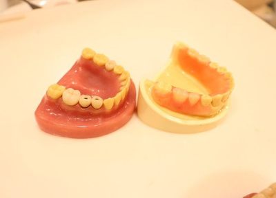歯茎の状態なども確認した上で、患者さまのご希望に添った入れ歯をご提案させていただきます