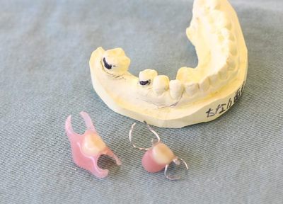Q.入れ歯の種類について教えてください。