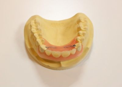 入れ歯が完成するまでの工程を一つ一つていねいに行うことで、お口に合ったものを作ります