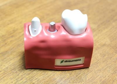 インプラント治療で元通りに噛めるようになる歯を取り戻すことができます