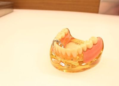 谷野歯科医院 入れ歯・義歯