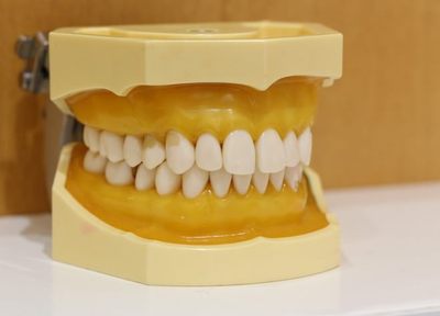Q.見た目に配慮した歯の治療が受けられますか？
