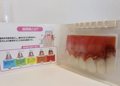 志賀歯科医院 歯周病