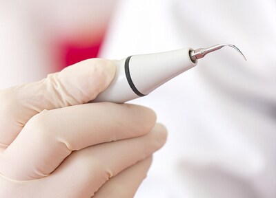 セルフケアで取り切れなかった汚れを、クリーニングで除去します