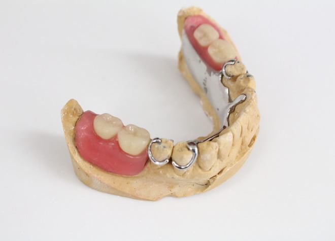 Q.入れ歯の治療でこれだけは伝えたいことはありますか？