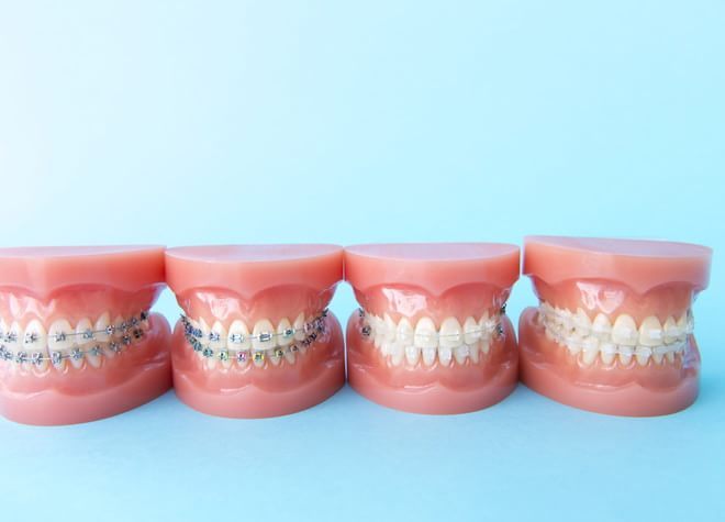 ワイヤー矯正は、複雑な生え方をした歯でも細かく調整しながら歯並びを整えることができます