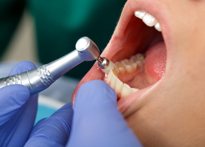 予防に力を入れたい方へ。歯を傷つけないクリーニングで、お口の環境を整えませんか？