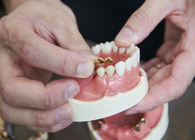 歯科医師と歯科技工士が連携して、お口に合った入れ歯を作製します
