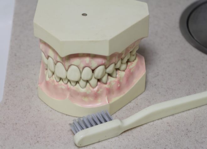 患者さまの磨き残しをチェックし、歯周病の再発を防ぎます