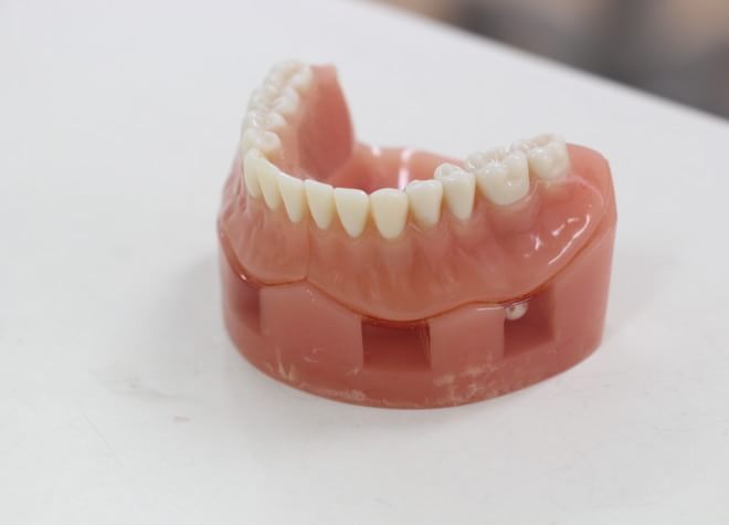 Q.患者さまに合う入れ歯を作るためのこだわりは何ですか？