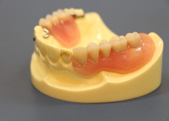 Q.入れ歯の調整や作製の際に、力を入れていることはありますか？