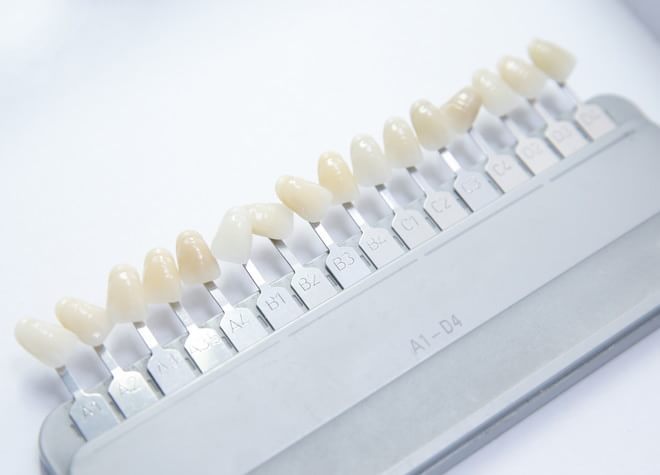 加齢や遺伝、食事・喫煙などの汚れをホワイトニングでもう一度白い歯に