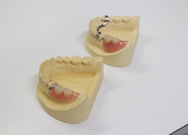 患者さまのお顔を細かく測定し、違和感の少ないオーダーメードの入れ歯を作製します
