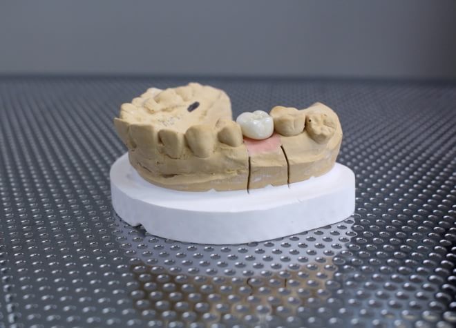 インプラントは、ご自身の歯で噛む状態に近い感覚を再現できる治療です