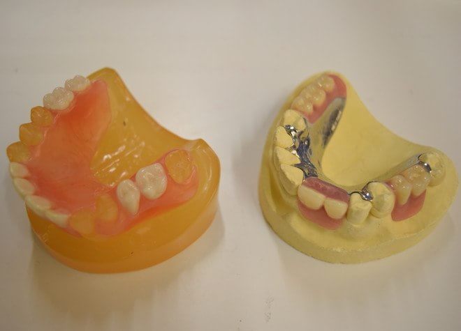 患者さまのご希望に添った入れ歯をご提供するために、自費の入れ歯もいろいろとご用意しました