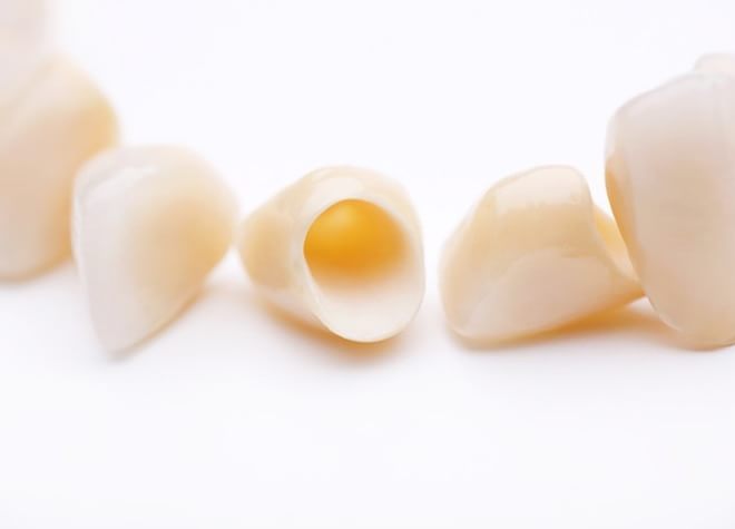 銀歯を使用しないセラミックの被せ物・詰め物