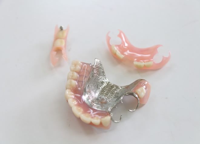 入れ歯は1本の歯であっても、ほかの歯を守ることにつながります