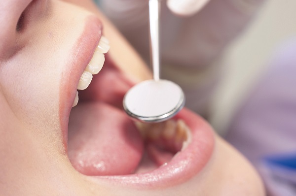 失った歯の第４の選択肢・『歯牙移植』（保険適用）