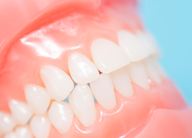 患者さま自身の歯を守るためには、健全な噛み合わせが大切です