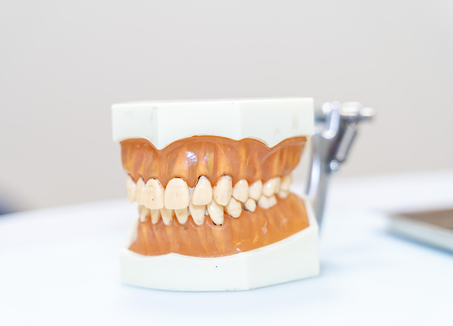 歯周病治療に力を入れている院長が、軽度から重度の症状まで幅広く対応します