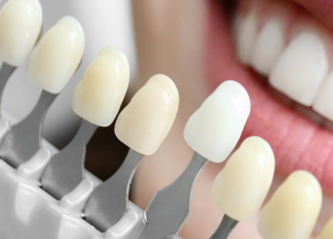 歯の色味のことで困っている方のために、ホワイトニングにも対応しています