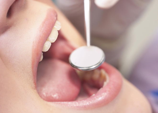 早期の歯周病対策が、将来に残せる歯の数や健康に影響します