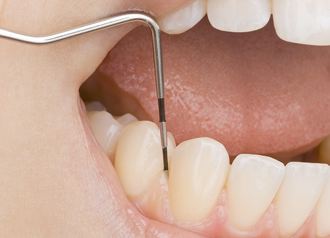 歯周病予防にも力を入れ、歯を守るサポートをしてまいります