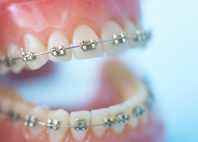 歯並びを整え、虫歯になりにくい歯に。矯正治療の知識を深めた歯科医師が担当します
