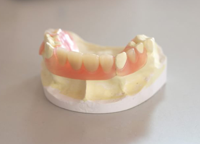 患者さまのお口に合わせて作製・調整し、長く快適に使用できる入れ歯のご提供に努めます