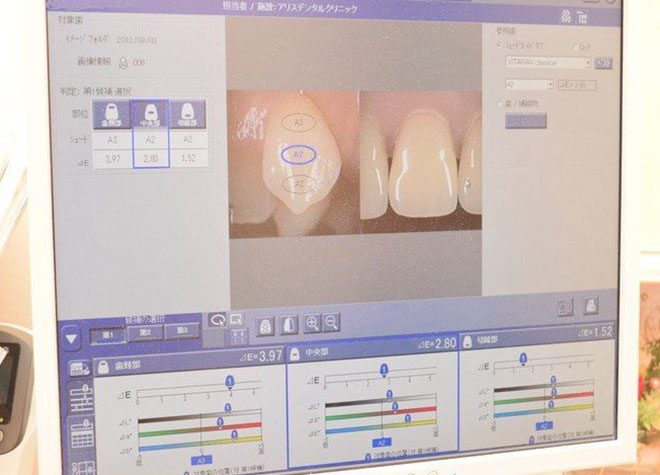 患者さまの歯の色を分析する機械を導入して、色の判別をしています