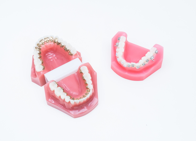 歯並びが気になる方や噛み合わせに違和感を覚える方には、矯正治療を提案しています