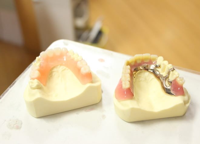 歯を失ってしまった場合の選択肢として、入れ歯・義歯またはインプラントをご提案いたします