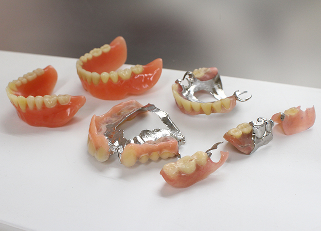 歯を失ってしまった方もお食事を楽しめるように、入れ歯・義歯の治療に力を入れています