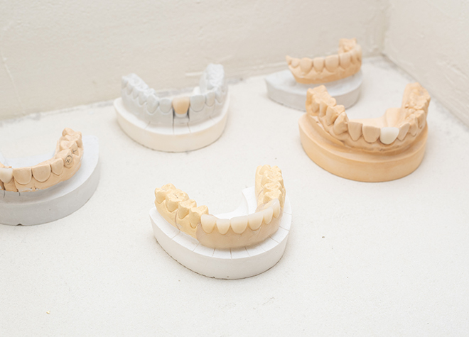 歯科技工士との連携を密に行うことで、より噛みやすい入れ歯の作製を目指します