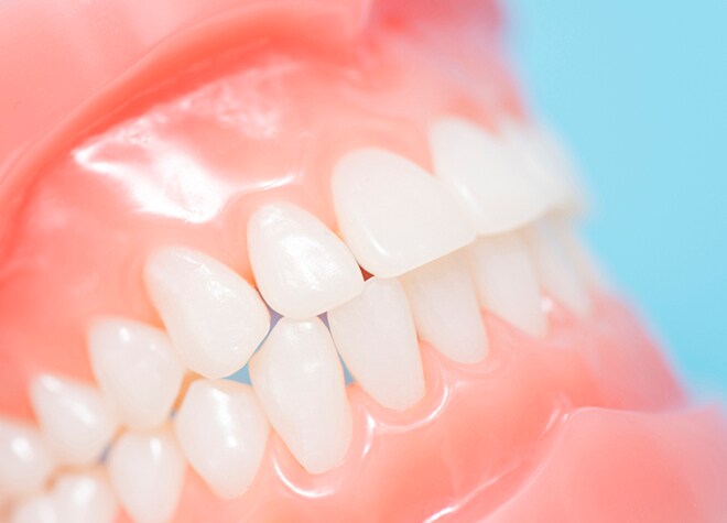 お口にフィットする入れ歯を作るために、型取りをあえて2回行っています