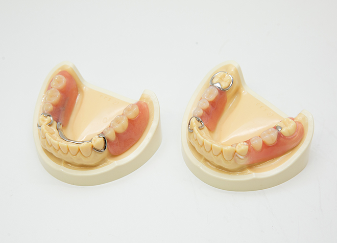 インプラントや入れ歯など各種補綴治療に力を入れ、噛み合わせの改善を目指しています。