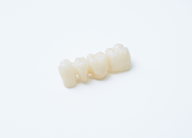 被せ物・詰め物は様々な素材をご用意し、銀歯に悩む方にも対応しています。