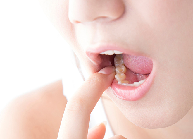 歯周病の治療だけでなく予防にも取り組み、口内の健康維持に努めています