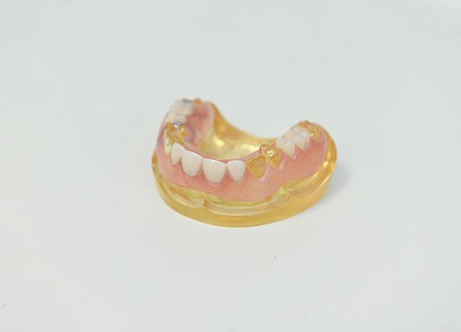 患者さまのお口の状態に合ったオーダーメードの入れ歯をご提供します