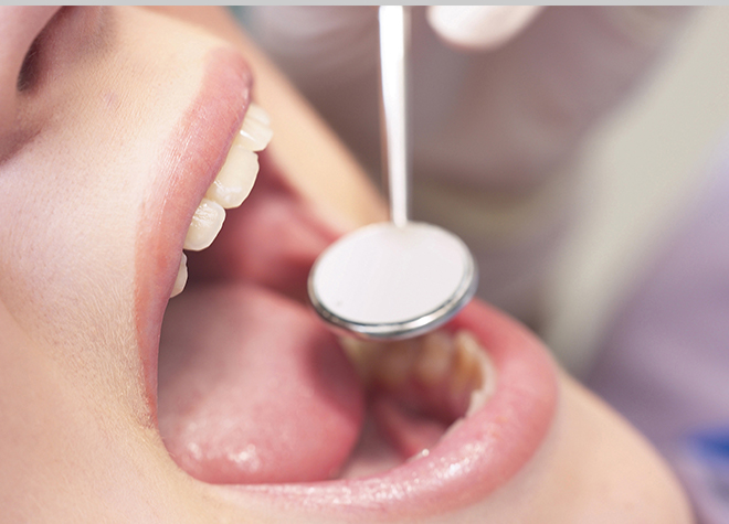 患者さまご自身で歯を守れるようになることを目指し、生活背景も考慮しながら治療やブラッシング指導をいたします