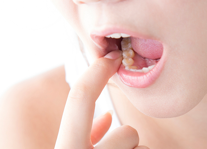 お口の中の細菌を除去することで歯周病の改善を図ります