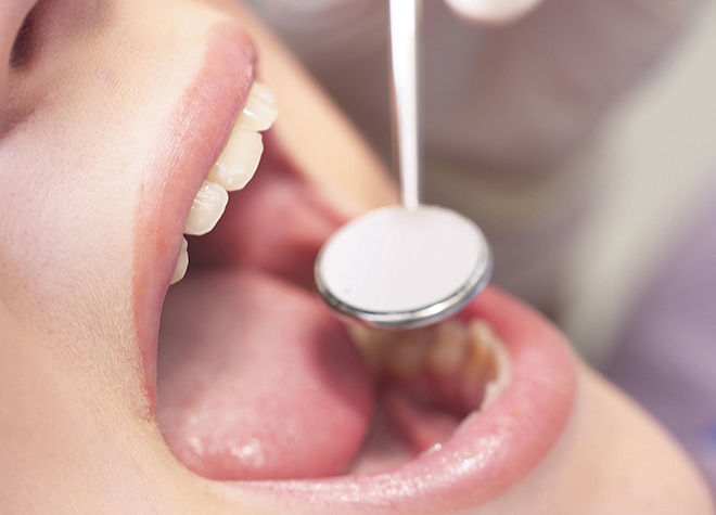 お口の健康を維持するためにも、定期的な検診で歯周病をしっかり予防しましょう