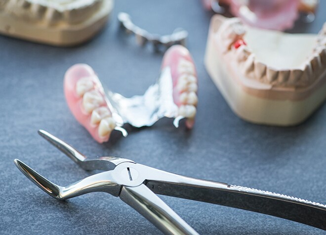 3種類の入れ歯・義歯をご用意しております