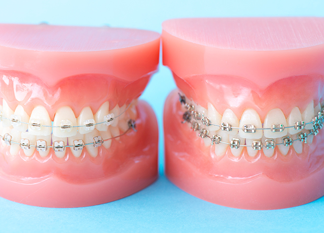 歯並びを整えることで表情が変わるだけでなく、噛みやすさや虫歯予防にもつながるといったメリットがあります
