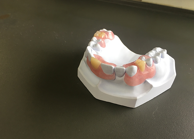 患者さまのご要望に添えるような入れ歯・義歯の提供を目指しております