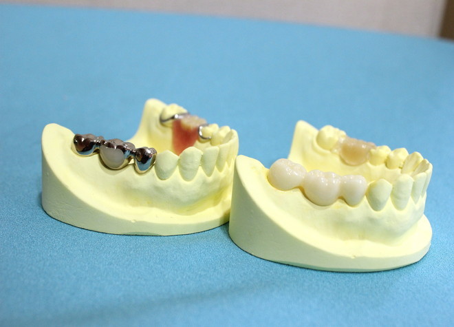 美しい歯のための美容診療