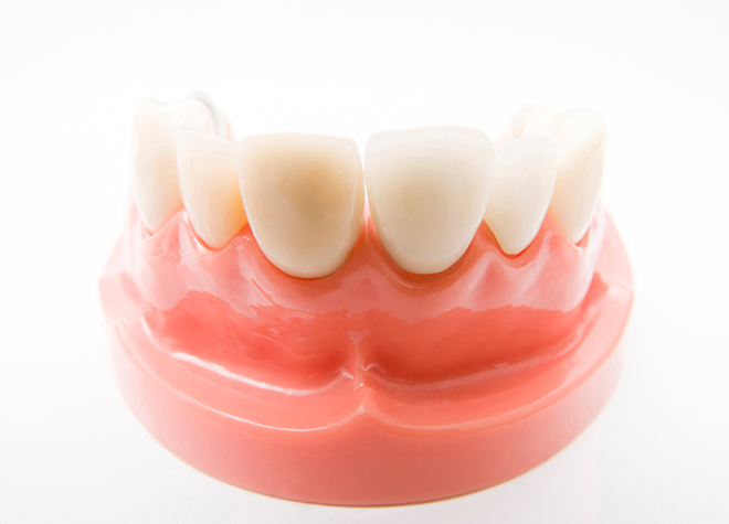 歯を支える土台である、歯茎を美しくするための治療も得意としています