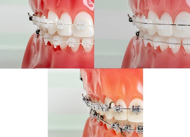 こだわり すずき矯正歯科 長崎市 浦上駅 Epark歯科