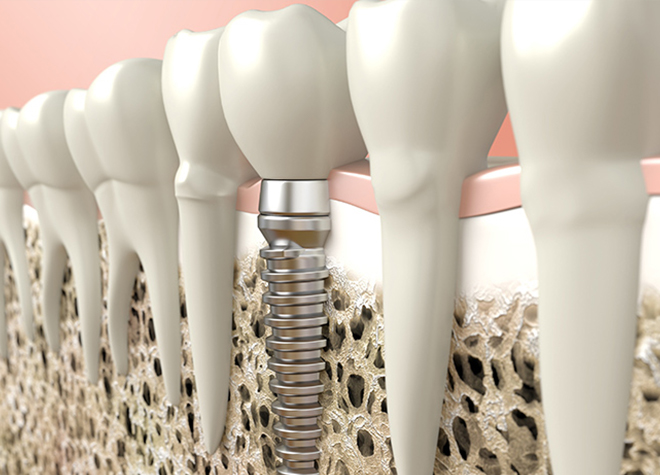 治療のリスクを抑えるために、複数の歯科医師によるオペに取り組んでいます